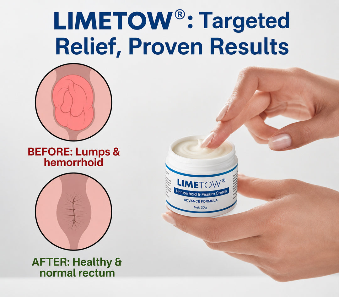 🔥𝙇𝙞𝙢𝙞𝙩𝙚𝙙-𝙏𝙞𝙢𝙚 𝙊𝙛𝙛𝙚𝙧 | LIMETOW® 𝗛𝗲𝗺𝗼𝗿𝗿𝗵𝗼𝗶𝗱 & 𝗙𝗶𝘀𝘀𝘂𝗿𝗲 𝗖𝗿𝗲𝗮𝗺