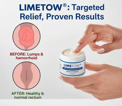 🔥𝙇𝙞𝙢𝙞𝙩𝙚𝙙-𝙏𝙞𝙢𝙚 𝙊𝙛𝙛𝙚𝙧 | LIMETOW® 𝗛𝗲𝗺𝗼𝗿𝗿𝗵𝗼𝗶𝗱 & 𝗙𝗶𝘀𝘀𝘂𝗿𝗲 𝗖𝗿𝗲𝗮𝗺
