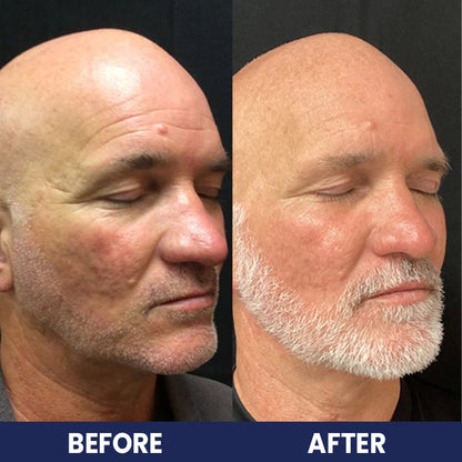 LIMETOW™ Collagen For Men