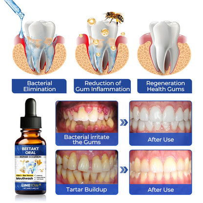 LIMETOW® BeeTakt Oral Repair Solution🔥🔥