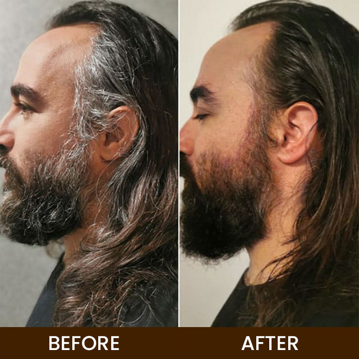 LIMETOW™ Anti-Greying Hair Serum