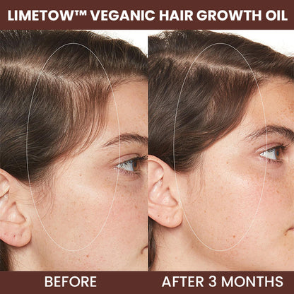 LIMETOW™ Veganic Hair Growth Oil