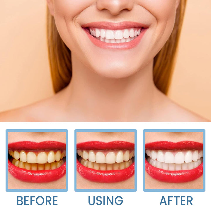 LIMETOW™ Teeth Whitening Pen