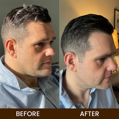 LIMETOW™ Anti-Greying Hair Serum