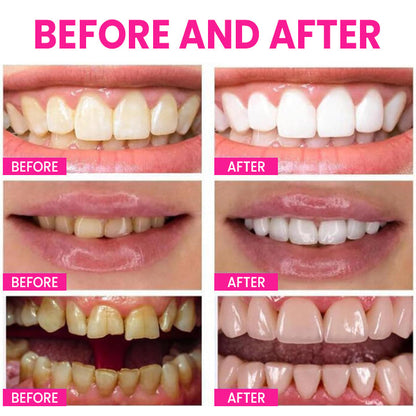 LIMETOW™ Teeth Whitening Pen