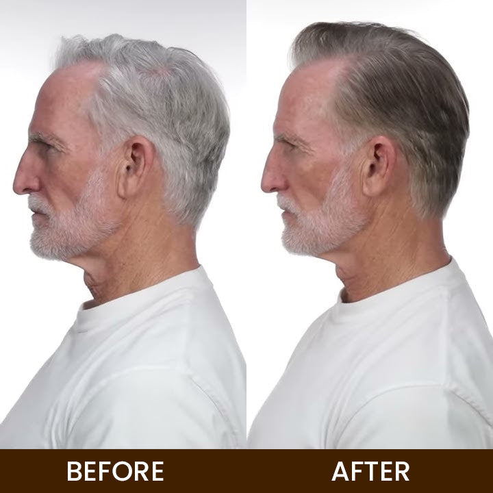 LIMETOW™ Anti-Greying Hair Serum