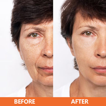 🔥HOT SALE🔥 ✨✨LIMETOW™ Vitamin C Anti-Aging Serum✨✨