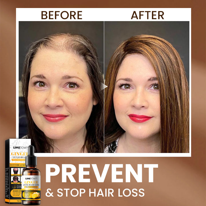 LIMETOW™ Anti-Hair Loss Treatment Essence