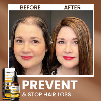 LIMETOW™ Anti-Hair Loss Treatment Essence