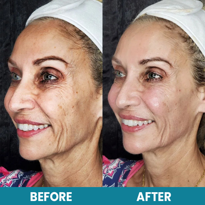 LIMETOW™ LuxeLift Skin Firming Youth Butter
