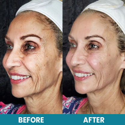 LIMETOW™ LuxeLift Skin Firming Youth Butter