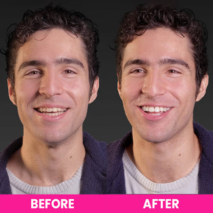 LIMETOW™ Teeth Whitening Strips