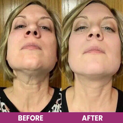 LIMETOW™ Hydrolyzed Collagen Neck Cream