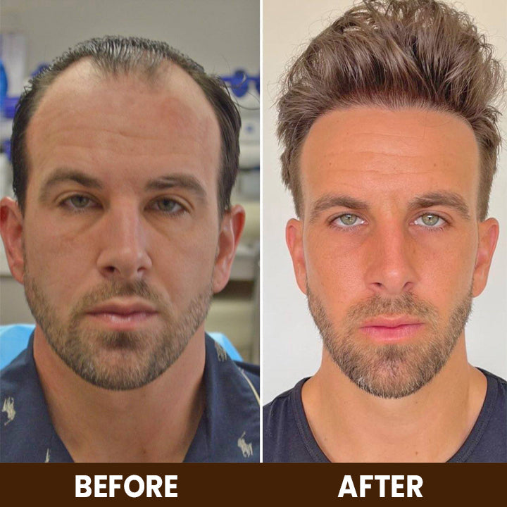 LIMETOW™ Anti-Hair Loss Treatment Essence