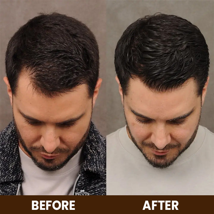 LIMETOW™ Anti-Hair Loss Treatment Essence
