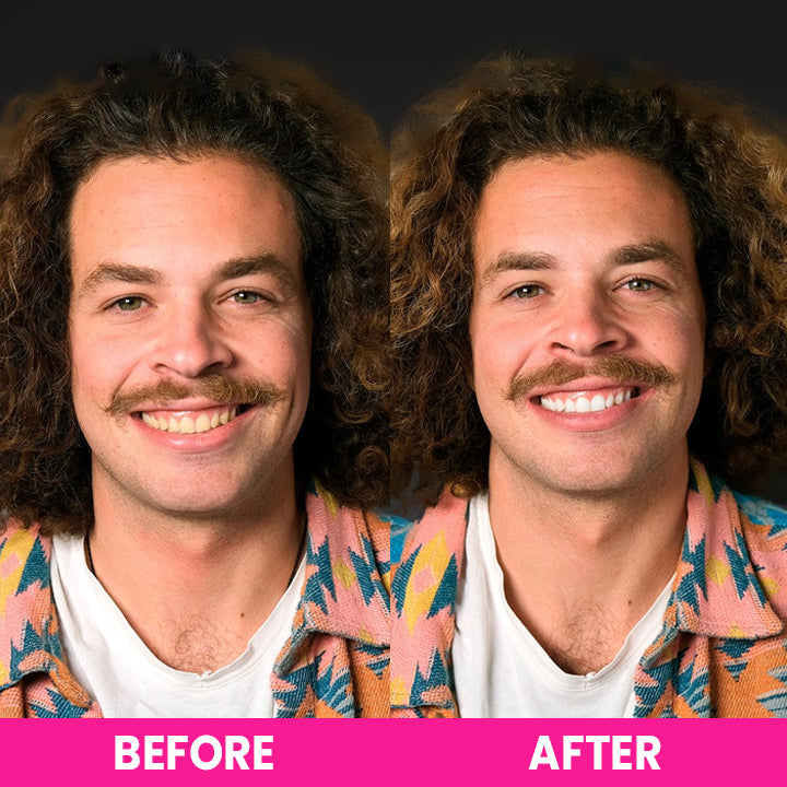 LIMETOW™ Teeth Whitening Strips