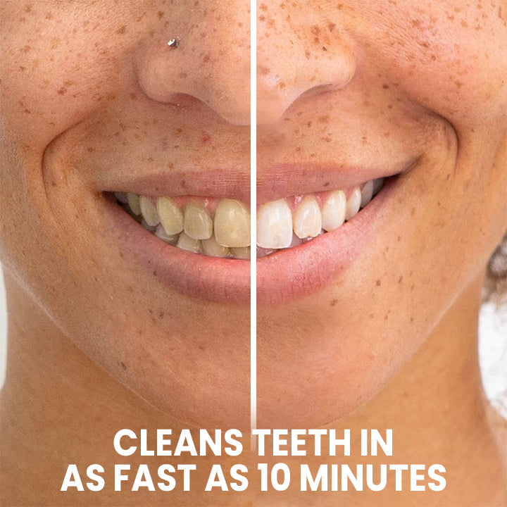 LIMETOW™ Teeth Whitening Pen