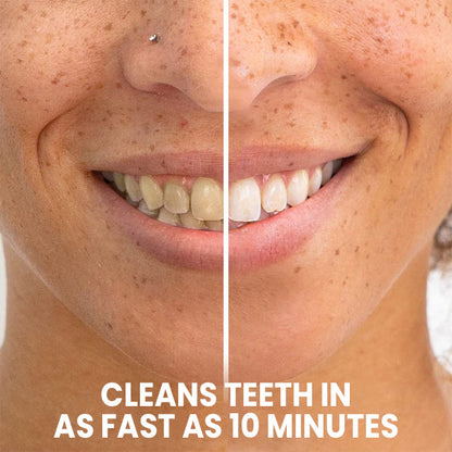 LIMETOW™ Teeth Whitening Pen