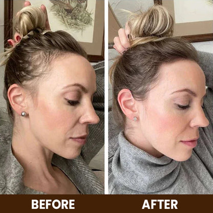 LIMETOW™ Anti-Hair Loss Treatment Essence