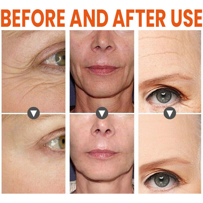 🔥HOT SALE🔥 ✨✨LIMETOW™ Vitamin C Anti-Aging Serum✨✨