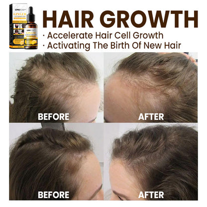 LIMETOW™ Anti-Hair Loss Treatment Essence