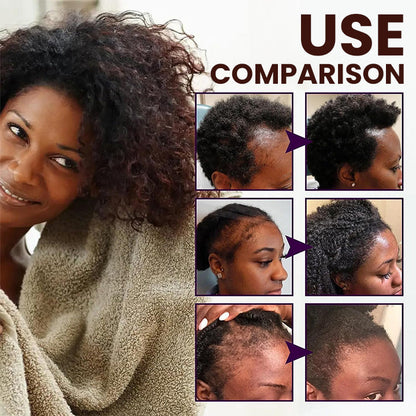 LIMETOW™ Veganic Hair Growth Oil