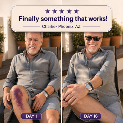 💥160K+ SOLD💕- LIMETOW® Bruise Repair & Skin-Strengthening Cream | Eliminates Bruises and Restores Firm Skin in 24 Hours