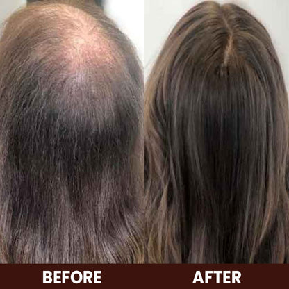 LIMETOW™ Veganic Hair Growth Oil