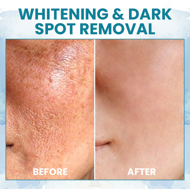 LIMETOW™ LuxeLift Skin Firming Youth Butter
