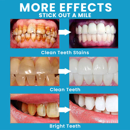 LIMETOW™ Teeth Whitening Essence