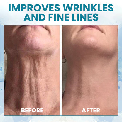 LIMETOW™ LuxeLift Skin Firming Youth Butter