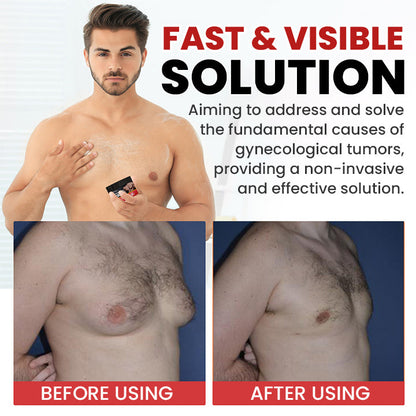 🔥New Product Discounts🔥 Last Day✨LIMETOW™ Gynecomastia Cream