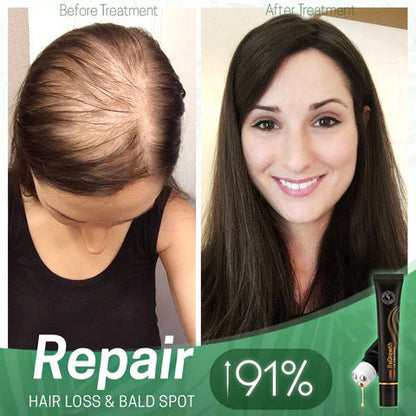 LIMETOW™ ORGANIC HAIR SERUM ROLLER (BUY 2 GET 1 FREE)