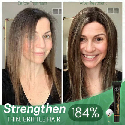 LIMETOW™ ORGANIC HAIR SERUM ROLLER (BUY 2 GET 1 FREE)