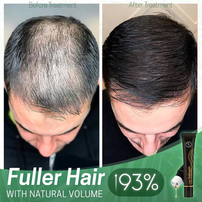 LIMETOW™ ORGANIC HAIR SERUM ROLLER (BUY 2 GET 1 FREE)