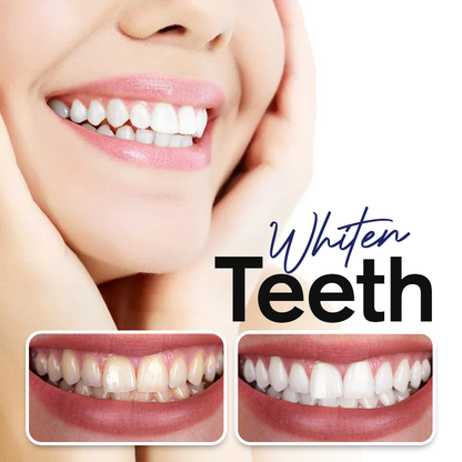 LIMETOW™ Teeth Whitening Spray