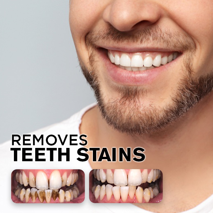 LIMETOW™ Teeth Whitening Spray