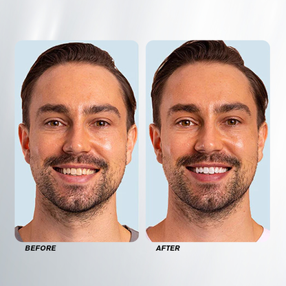 LIMETOW™ Teeth Whitening Spray