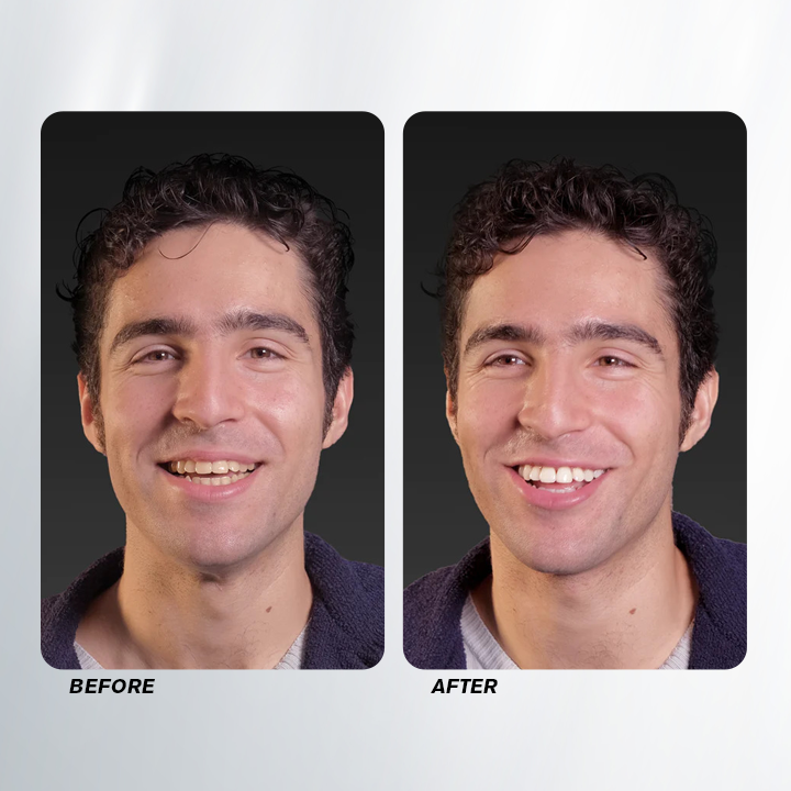 LIMETOW™ Teeth Whitening Spray