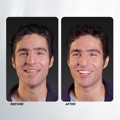 LIMETOW™ Teeth Whitening Spray