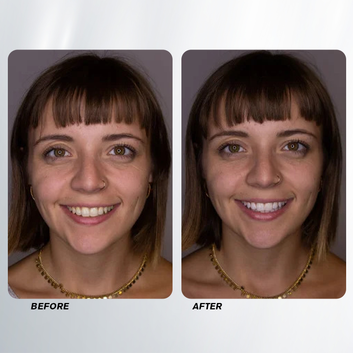 LIMETOW™ Teeth Whitening Spray