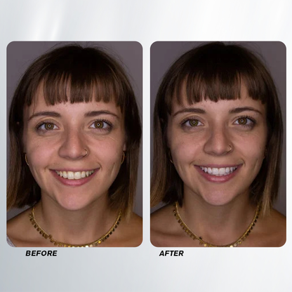 LIMETOW™ Teeth Whitening Spray