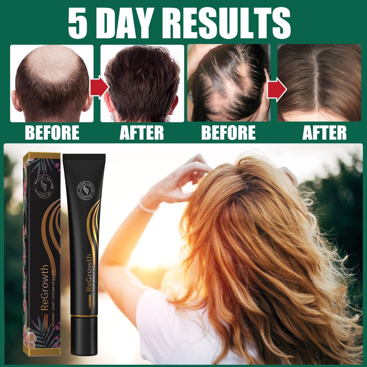 LIMETOW™ ORGANIC HAIR SERUM ROLLER (BUY 2 GET 1 FREE)